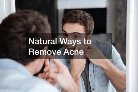 Natural Ways to Remove Acne