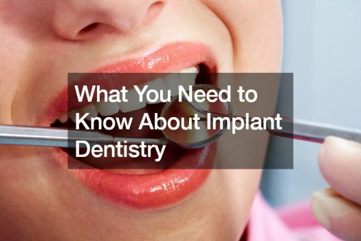 What You Need to Know About Implant Dentistry